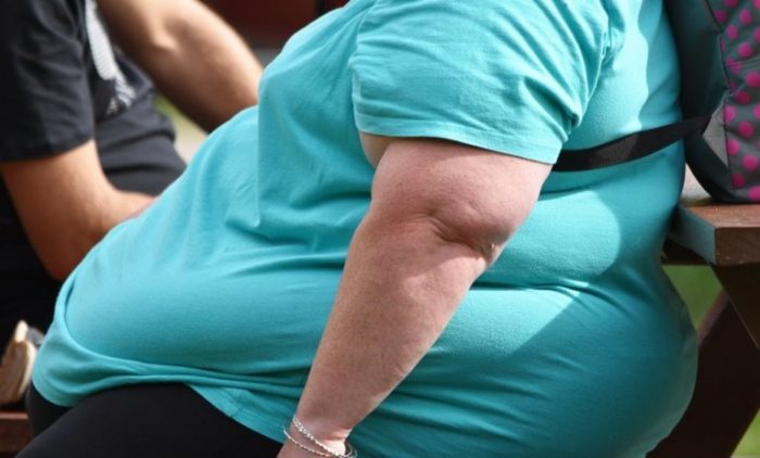 Se aprueba resolución que reconoce la obesidad como enfermedad crónica